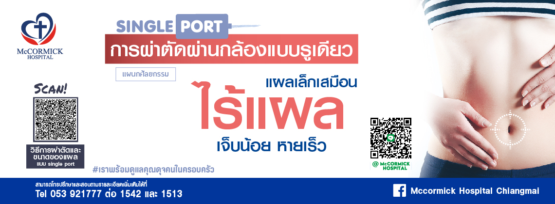 การผ่าตัดผ่านกล้องเทคนิครูเดียว (Single Port Laparoscopic Surgery)