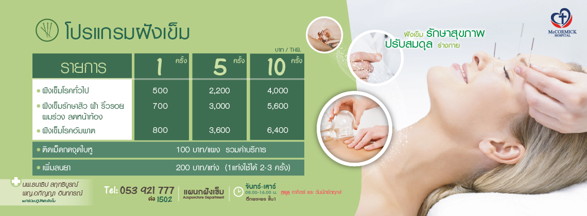 ฝังเข็ม