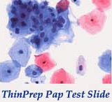 รู้ทันไวรัส HPV ตัวร้าย สาเหตุสำคัญของมะเร็งปากมดลูก