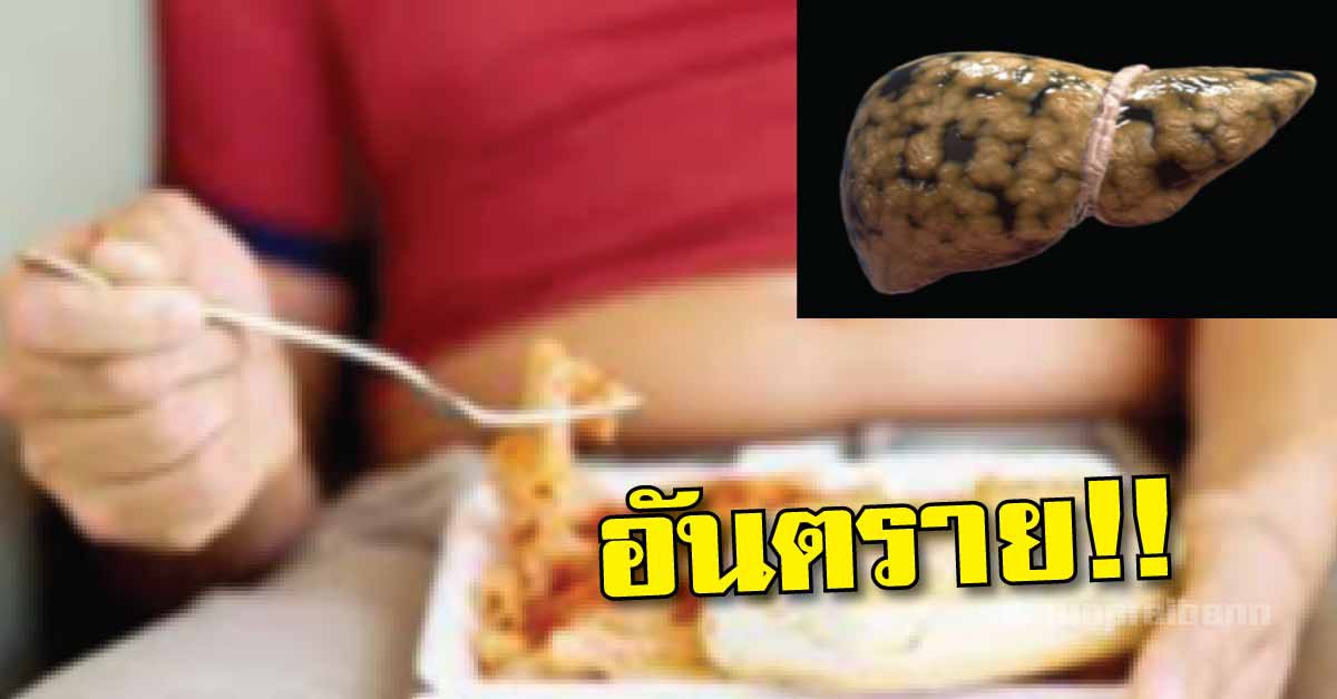 เกราะป้องกันตัวเองให้ห่างจากไขมันเกาะตับ