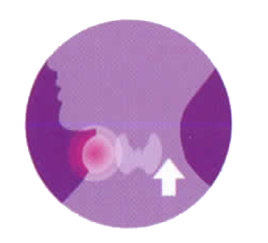 โรคไทรอยด์ชนิดผอม ภาวะไทรอยด์เป็นพิษ (Hyperthyroid คอพอกเป็นพิษ)