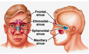 โพรงจมูกและไซนัสอักเสบ (Rhinosinusitis)