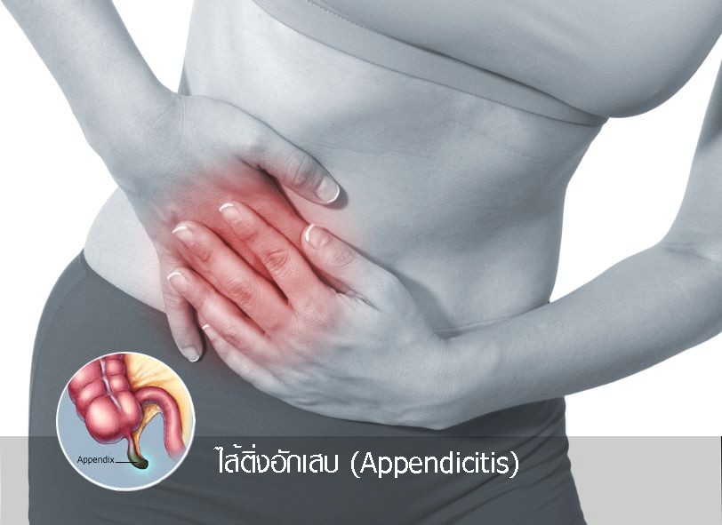 ไส้ติ่งอักเสบ (Appendicitis)