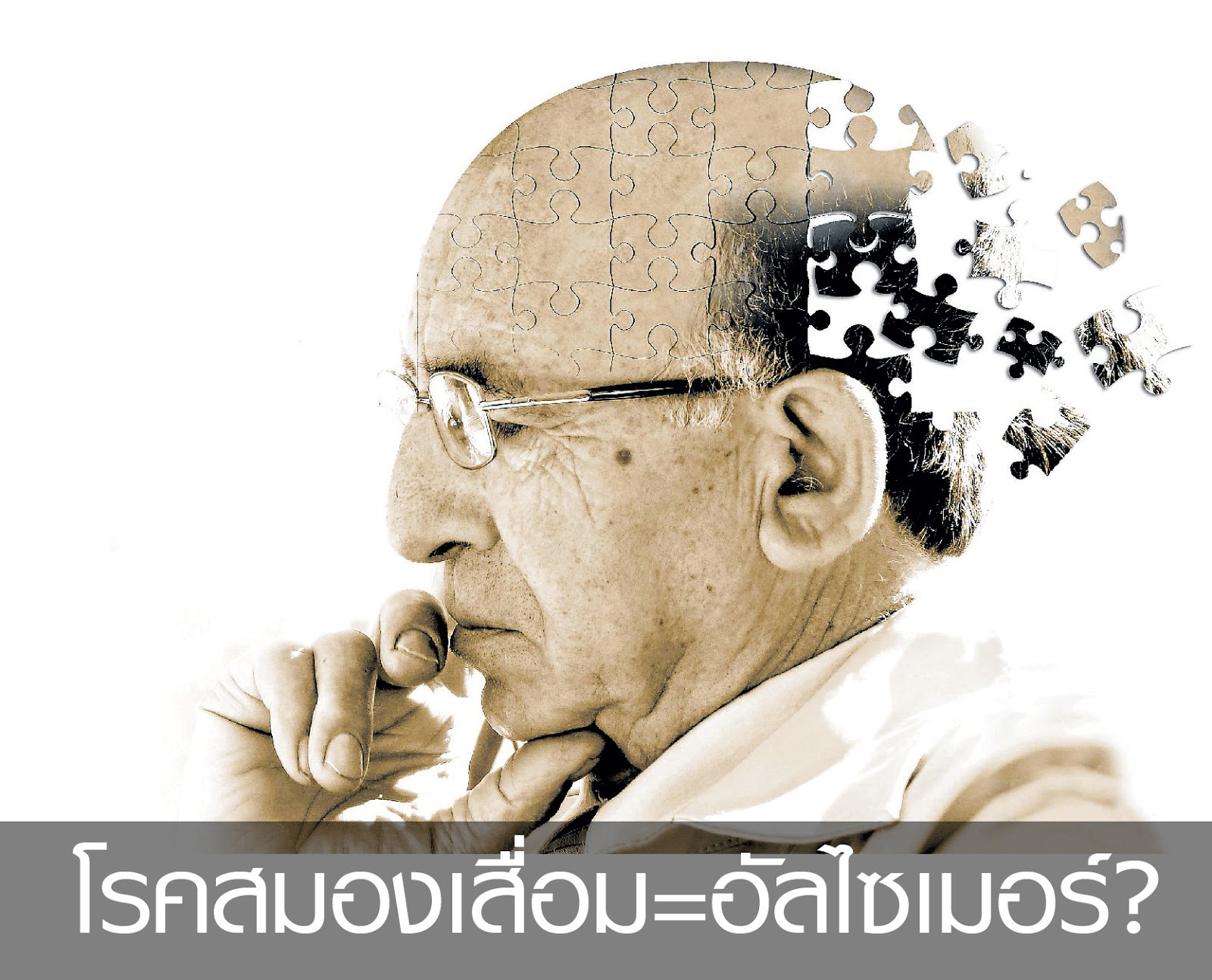 โรคภาวะสมองเสื่อม (Dementia)