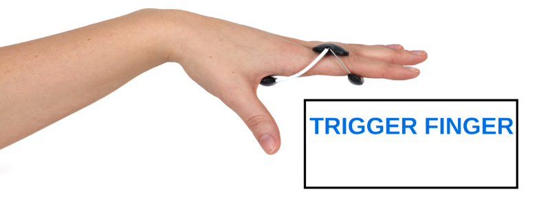 โรคนิ้วล็อค (Trigger finger)