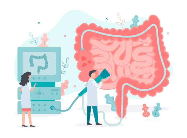 การส่องกล้องตรวจลำไส้ใหญ่ (Colonoscopy)